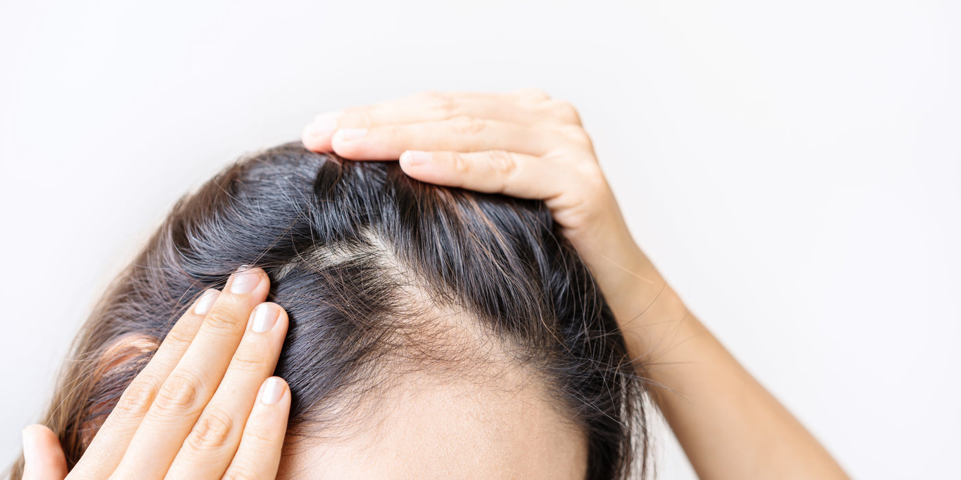 La chute de cheveux chez la femme