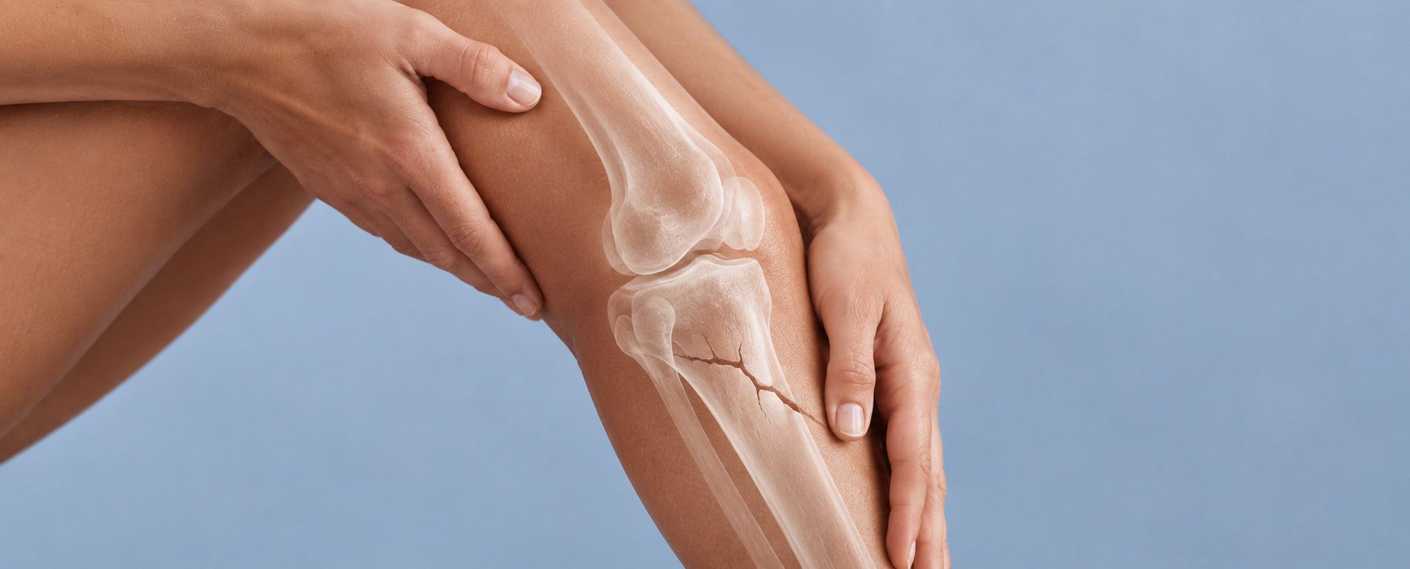 Os fragiles : causes, désagréments et solutions naturelles